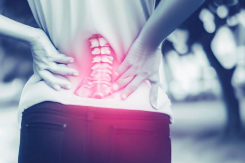Back Pain after Epidural