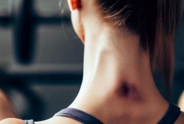CrossFit Bruises Neck